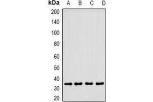 Western blot analysis of CLEC12A expression in MCF7 (A), U937 (B), mouse heart (C), rat liver (D) whole cell lysates. (CLEC12A antibody)