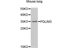Western blot analysis of extracts of mouse lung, using PDLIM3 antibody (ABIN5975262) at 1/1000 dilution. (PDLIM3 antibody)