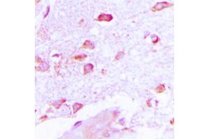 Immunohistochemical analysis of NSG2 staining in human brain formalin fixed paraffin embedded tissue section. (NSG2 antibody  (Center))