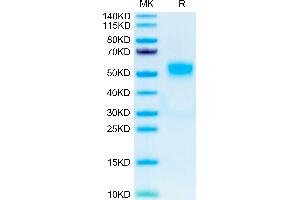 Human CD19 on Tris-Bis PAGE under reduced condition. (CD19 Protein (AA 20-291) (His tag))