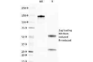 SDS-PAGE Analysis Purified CD269 / TNFRSF17 Mouse Monoclonal Antibody (BCMA/2366). (BCMA antibody  (AA 78-184))