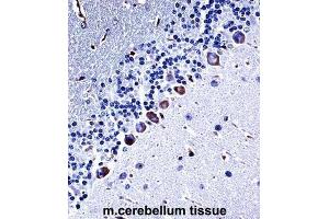 Immunohistochemistry (IHC) image for anti-Casein Kinase 1, gamma 3 (CSNK1G3) antibody (ABIN2997618) (CSNK1G3 antibody)