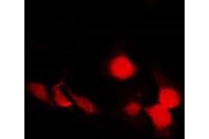 ABIN6278222 staining COS7 by IF/ICC. (STXBP1 antibody)