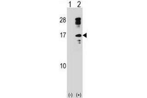 Western blot analysis of CLC (arrow) using rabbit polyclonal CLC Antibody (C-term) .