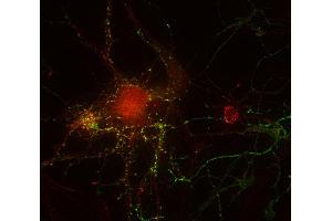 Indirect immunostaining of PFA fixed rat hippocampus neurons with anti-ZnF 365 (dilution 1 : 500; red) and mouse anti-synapsin 1 (cat. (ZNF365 antibody  (AA 363-410))