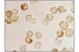 Immunocytochemistry staining of HeLa using AP30669PU-N at 10 μg/ml. (MTA2 antibody  (AA 652-668))