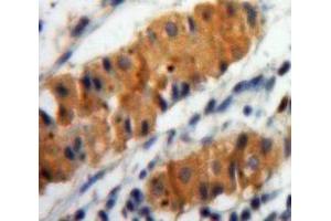 Used in DAB staining on fromalin fixed paraffin-embedded Stomach tissue (ALOX15 antibody  (AA 170-312))