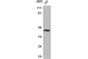 Western Blot analysis of 293 cells using Phospho-MEK-4 (T261) Polyclonal Antibody (MAP2K4 antibody  (pThr261))