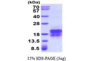 SDS-PAGE (SDS) image for Vascular Endothelial Growth Factor C (VEGFC) (AA 112-227) protein (His tag) (ABIN5854525)