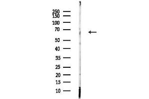 anti-Transforming Growth Factor, beta Receptor II (70/80kDa) (TGFBR2) (pSer553) antibody