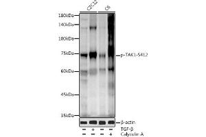 Western blot analysis of extracts of various cell lines, using Phospho-T-S412 antibody (ABIN3019511, ABIN3019512, ABIN3019513 and ABIN6225441) at 1:1000 dilution. (MAP3K7 antibody  (pSer412))
