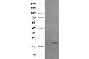 Image no. 1 for anti-Ubiquitin-Conjugating Enzyme E2G 2 (UBE2G2) antibody (ABIN1501635) (UBE2G2 antibody)