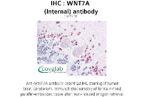 Image no. 1 for anti-Wingless-Type MMTV Integration Site Family, Member 7A (WNT7A) (Internal Region) antibody (ABIN1740837) (WNT7A antibody  (Internal Region))