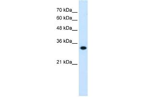 WB Suggested Anti-HMGCL Antibody Titration:  0. (HMGCL antibody  (C-Term))