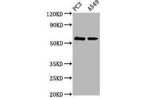 Western Blot Positive WB detected in: PC-3 whole cell lysate, A549 whole cell lysate All lanes: CYP1B1 antibody at 6. (CYP1B1 antibody  (AA 282-409))