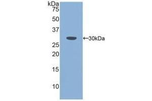 Detection of Recombinant PLS3, Mouse using Polyclonal Antibody to Plastin 3 (PLS3) (Plastin 3 antibody  (AA 5-251))