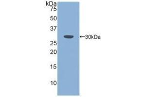 Detection of Recombinant PLS3, Mouse using Polyclonal Antibody to Plastin 3 (PLS3)
