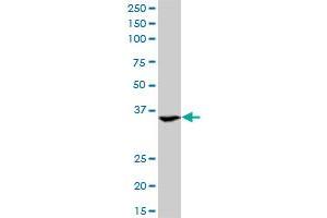 ASGR2 monoclonal antibody (M05), clone 1D7. (Asialoglycoprotein Receptor 2 antibody  (AA 1-287))