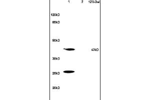 Lane 1: mouse brain lysates Lane 2: mouse kidney lysates probed with Anti HSD17B2 Polyclonal Antibody, Unconjugated (ABIN750193) at 1:200 in 4 °C.