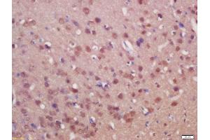Formalin-fixed and paraffin embedded rat brain labeled with Anti-SUFU/Suppressor of Fused Polyclonal Antibody, Unconjugated  at 1:200 followed by conjugation to the secondary antibody and DAB staining