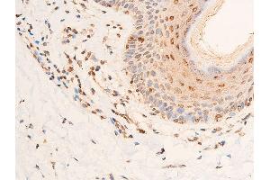 Immunohistochemistry (IHC) image for anti-Checkpoint Kinase 2 (CHEK2) (pThr383) antibody (ABIN6256552)
