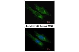 ICC/IF Image Immunofluorescence analysis of methanol-fixed HeLa, using SUCLG2, antibody at 1:200 dilution. (SUCLG2 antibody)