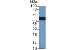 Western Blotting (WB) image for anti-Nucleophosmin (Nucleolar phosphoprotein B23, Numatrin) (NPM1) (AA 20-154) antibody (ABIN1175784)