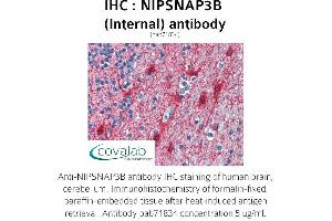 Image no. 1 for anti-Nipsnap Homolog 3B (NIPSNAP3B) (Internal Region) antibody (ABIN1737369)