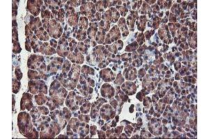 Image no. 6 for anti-V-Akt Murine Thymoma Viral Oncogene Homolog 1 (AKT1) antibody (ABIN1496558) (AKT1 antibody)