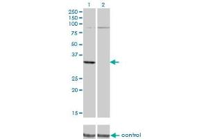 Western blot analysis of PRPS2 over-expressed 293 cell line, cotransfected with PRPS2 Validated Chimera RNAi (Lane 2) or non-transfected control (Lane 1). (PRPS2 antibody  (AA 160-269))