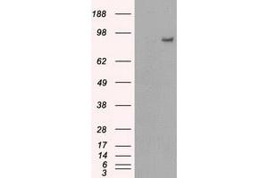 HEK293T cells were transfected with the pCMV6-ENTRY control (Left lane) or pCMV6-ENTRY PDE10A (Right lane) cDNA for 48 hrs and lysed. (PDE10A antibody)