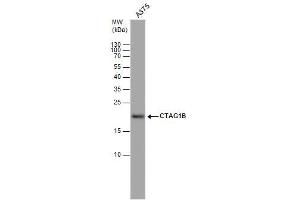WB Image CTAG1B antibody detects CTAG1B protein by western blot analysis. (CTAG1B antibody)