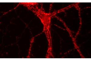 Immunofluorescence labeling of hippocampus neurons, (dilution 1 : 500). (VAMP1, 2, 3 (AA 1-81) antibody)