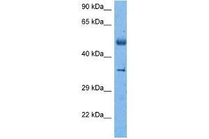 Host:  Rabbit  Target Name:  SUV39H2  Sample Tissue:  Lung Tumor lysates  Antibody Dilution:  1ug/ml (SUV39H2 antibody  (C-Term))