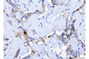 IHC analysis of Desmoglein 2/DSG2 using anti-Desmoglein 2/DSG2 antibody (ABIN7600804). (Desmoglein 2 antibody  (AA 24-1020))