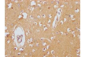 IHC image of ABIN7127430 diluted at 1:100 and staining in paraffin-embedded human brain tissue performed on a Leica BondTM system. (Recombinant Clusterin antibody)