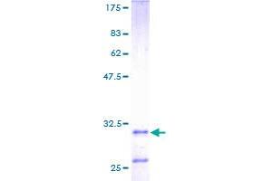 Image no. 1 for Histatin 3 (HTN3) (AA 1-51) protein (GST tag) (ABIN1307254)