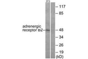 Western blot analysis of extracts from NIH-3T3 cells, using Adrenergic Receptor beta2 (Ab-346) Antibody.