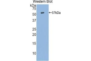 Detection of Recombinant HSPA14, Human using Polyclonal Antibody to Heat Shock 70 kDa Protein 14 (HSPA14)