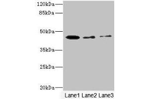 Western blot All lanes: SIGIRR antibody at 1. (SIGIRR antibody  (AA 1-120))
