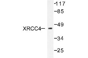 Image no. 1 for anti-X-Ray Repair Complementing Defective Repair in Chinese Hamster Cells 4 (XRCC4) antibody (ABIN271982) (XRCC4 antibody)