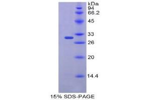 SDS-PAGE (SDS) image for FK506 Binding Protein 10, 65 KDa (FKBP10) (AA 316-573) protein (His tag) (ABIN2121083)