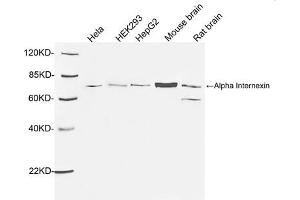 Western blot analysis of tissue and cell lysates using 1 µg/mL Rabbit Anti-Alpha Internexin Polyclonal Antibody (ABIN398867) The signal was developed with IRDyeTM 800 Conjugated Goat Anti-Rabbit IgG. (INA antibody  (AA 100-150))