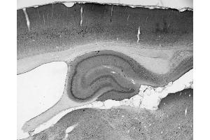 Adult rat hippocampus immunohistochemistry. (SNAPIN antibody  (AA 115-136))
