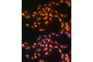 Immunofluorescence (IF) image for anti-SNAIL (SNAI1) (AA 1-100) antibody (ABIN1682836)