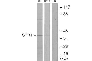Western blot analysis of extracts from Jurkat cells and HeLa cells, using SPR1 antibody.