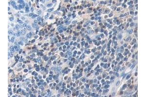 Immunohistochemistry (IHC) image for anti-Docking Protein 3 (DOK3) (AA 128-385) antibody (ABIN7443533)