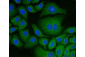 IF analysis of PDIA6 using anti-PDIA6 antibody (ABIN7600554). (PDIA6 antibody  (AA 20-440))