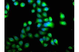 Immunofluorescence staining of Hela cells with ABIN7146412 at 1:100, counter-stained with DAPI. (PDE1A antibody  (AA 1-219))