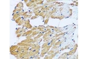 Immunohistochemistry of paraffin-embedded Rat heart using ARHGEF5 Polyclonal Antibody at dilution of 1:100 (40x lens).